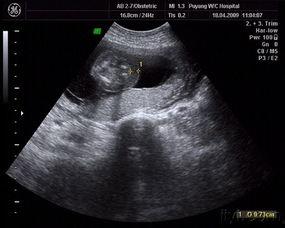 怀孕三个月图片,初显胎姿，幸福时光的美好见证